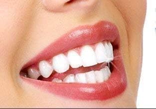 Miracle Brite Smile - 3% Hydrogen Peroxide Medical Food Grade, Peppermint, Lemon, Clove Leaf, Cinnamon and Rosemary