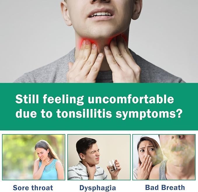 Tonsil Rinse-Tonsil Stone Remover Mouthwash，Natural Mouthwash Soothe Tonsils，Fight Bad Breath，Relieve Dry Mouth-Alcohol-Free，Breath Freshening，Mint Flavor-10 FL OZ