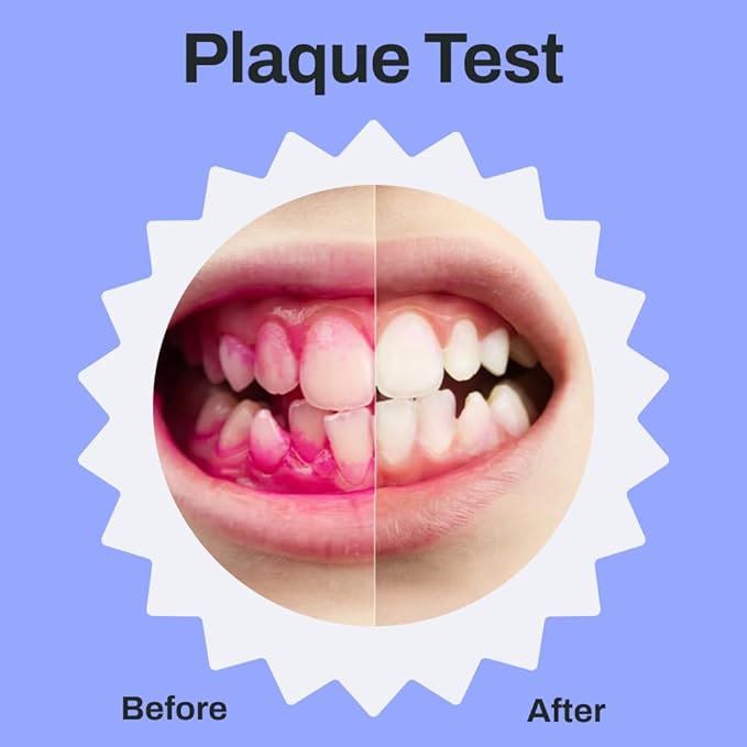 autobrush Kids Electric Toothbrush – Only ADA Accepted U-Shaped Toothbrush, Clinically Proven Up to 5.1X Better Cleaning, 30 Seconds, Full-Mouth 360 Coverage, LED Lights, Music, Ages 3-5, Hippo