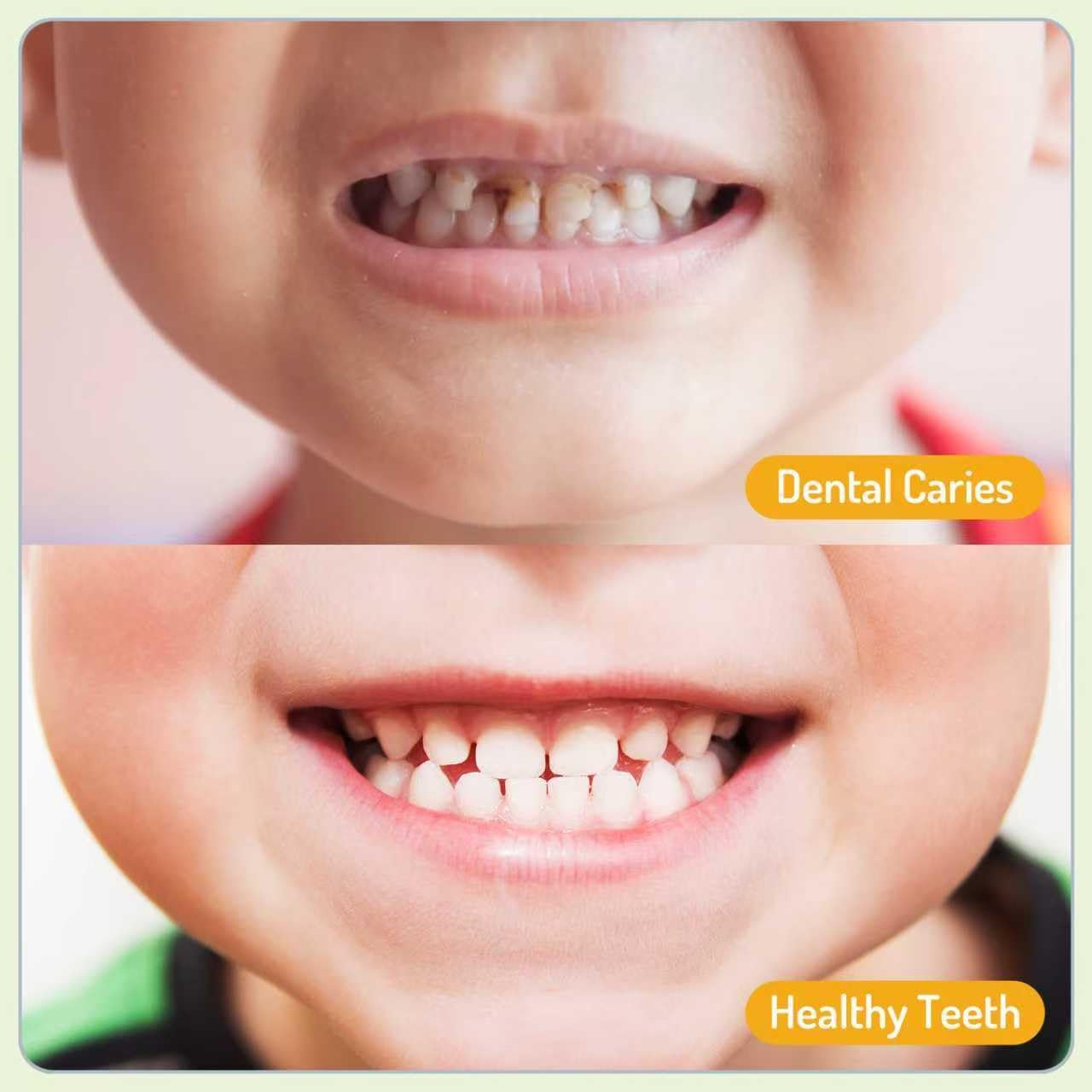 PEGO Kids Oral Spray - Fresh Breath for Children & Toddlers, Fruit-Flavored Oral Care Spray, Easy to Use, Perfect for Home & Travel for Baby's Daily Oral Care (1Pack, Grape)