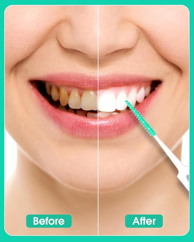 220 PCS Dental Floss Picks, Soft Silicone interdental Brush, Floss Picks for Teeth, Toothpicks Brush Between Teeth, Tooth Flossing Brush with Case, Disposable for Teeth Cleaning, Green Color