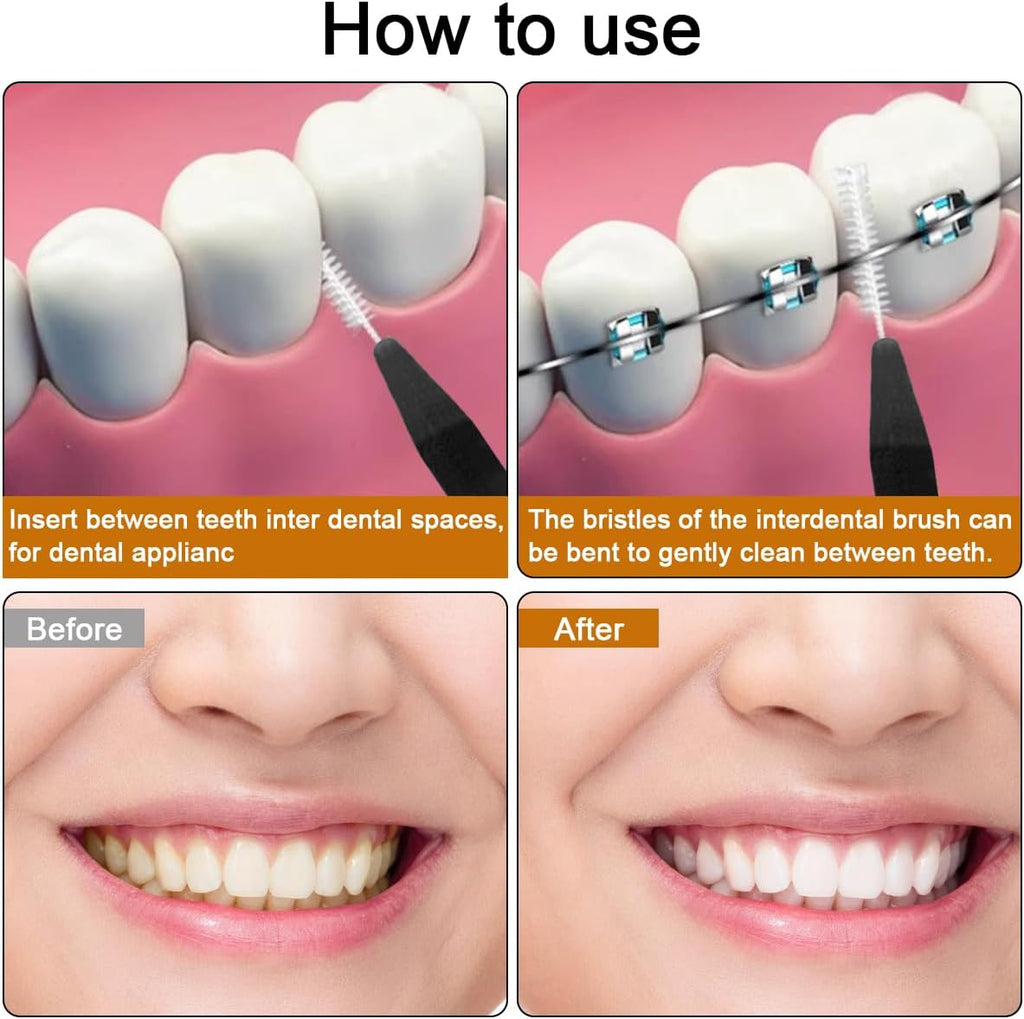 120 Pcs Interdental Brush + 25 Pcs Lip Wands Applicators Disposable, Braces Brush for Cleaner Interdental Brush Toothpick Dental Flossing Head Oral Dental Hygiene Flosser Tooth Cleaning Tools, Black