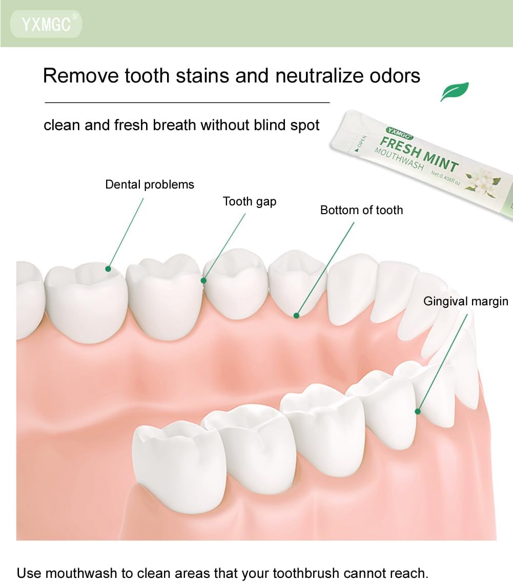 Travel Size Mouthwash Packets – Portable, Fresh Breath Anytime, Eliminates Bad Breath, Sugar-Free, Alcohol-Free, 20 Pack × 0.4 Fl Oz