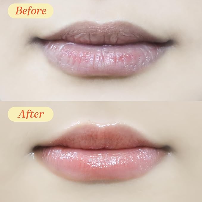 Best Kisser Lip Butter & Mask 0.35 OZ | 10g - 2-in-1 Lip Butter Mask for Deep Hydration, Soft and Smooth Lips - Effective Lip Treatment for Dry Cracked Lips & Night Lip Balm