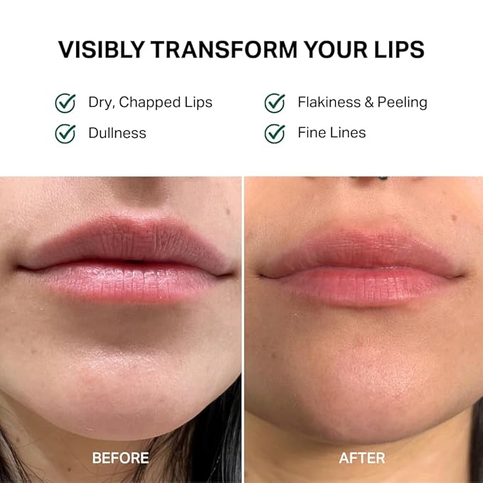 Y’OUR Intensive Healing Lip Balm & Overnight Lip Mask | Instantly Relieves & Repairs Dry, Chapped Lips | Deeply Hydrating Formula with Shea Butter & Rosehip Oil | Lightweight, Paraben & Silicon-Free