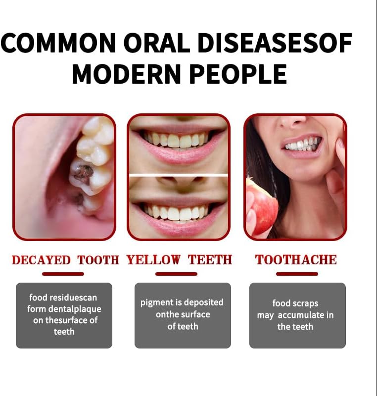 2 Pcs SP10 Probiotic Whitening Toothpaste, Deep Cleaning Care Remove Yellow Tooth Stains, with Probiotic Oral Health Management, Fresh Breath.