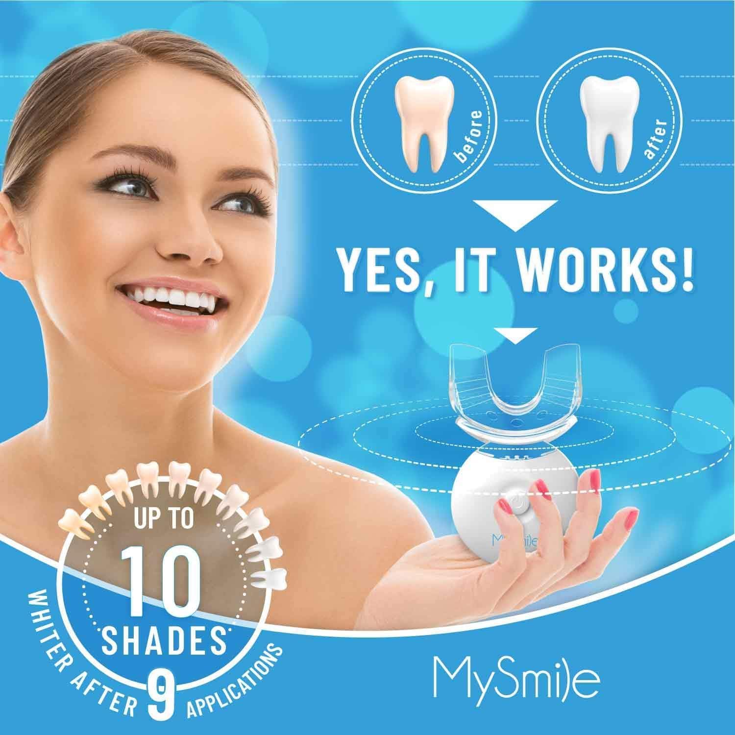 MySmile Teeth Whitening Kit with LED Light, 10 Min Fast Teeth Whitener with 3 x 35% Carbamide Peroxide Whitening Gel, Helps to Remove Stains from Coffee, Smoking, Wines, Soda, Food