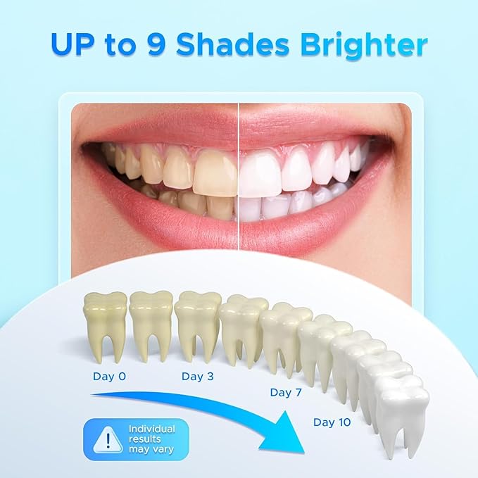 Luelli Teeth Whitening Pen, 40+ Uses - Travel Size Professional Tooth Whitener Serum, Extra Strength Organic Teeth Bleaching Gel for Sensitive Teeth, Instant Stain Removal, Simply White Smile, 4 Count