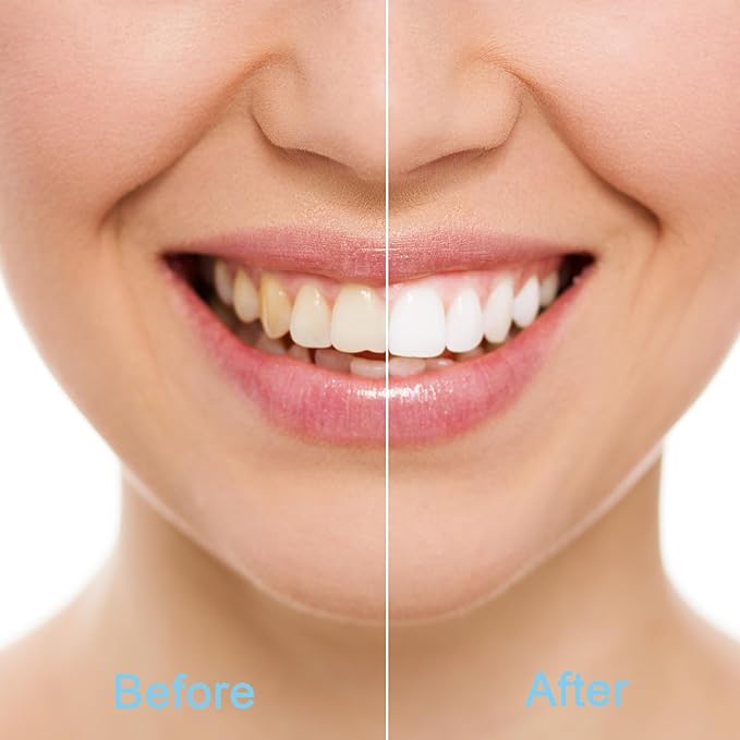 PEGO Adult Tooth Powder, Stain Remover for Teeth - Deep Cleaning Formula, Gentle & Non-Irritating, Effective Plaque Removal, Fresh Breath, Daily Oral Care for Adults (Probiotic)