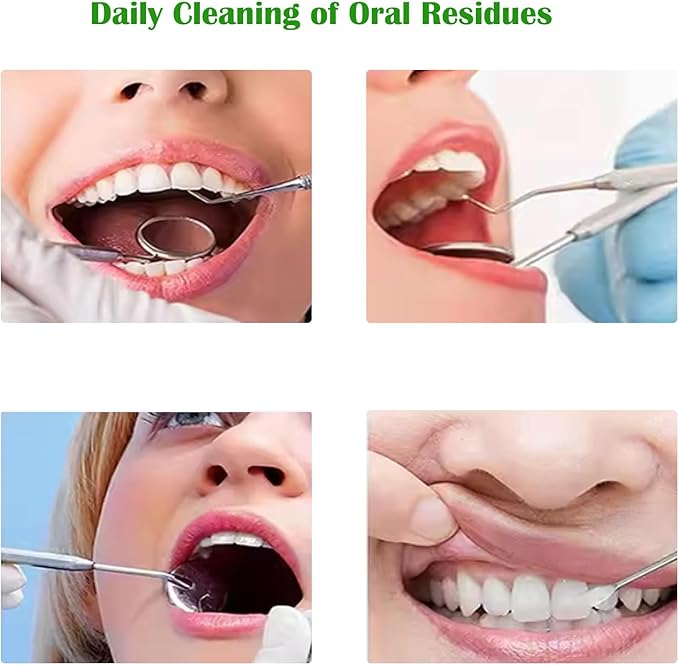 Teeth Cleaner Tool Kit Stainless Steel Plaque Tartar Remover Set of 6 with Metal Case, Tweezers, Oral Mirror, Teeth Cleaner, Probe, Stain Remover