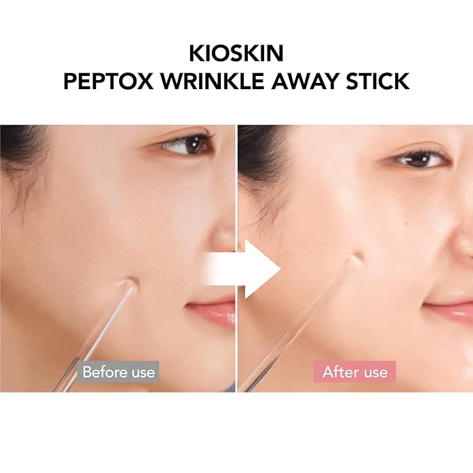 107% Crow’s Feet Improvement, 117% on Neck Lines & 109% on Nasolabial Lines – Boosts Elasticity – With Botulinum-Inspired Peptide and Collagen – Korean Skincare Korea’s Best Skincare Stick Kioskin