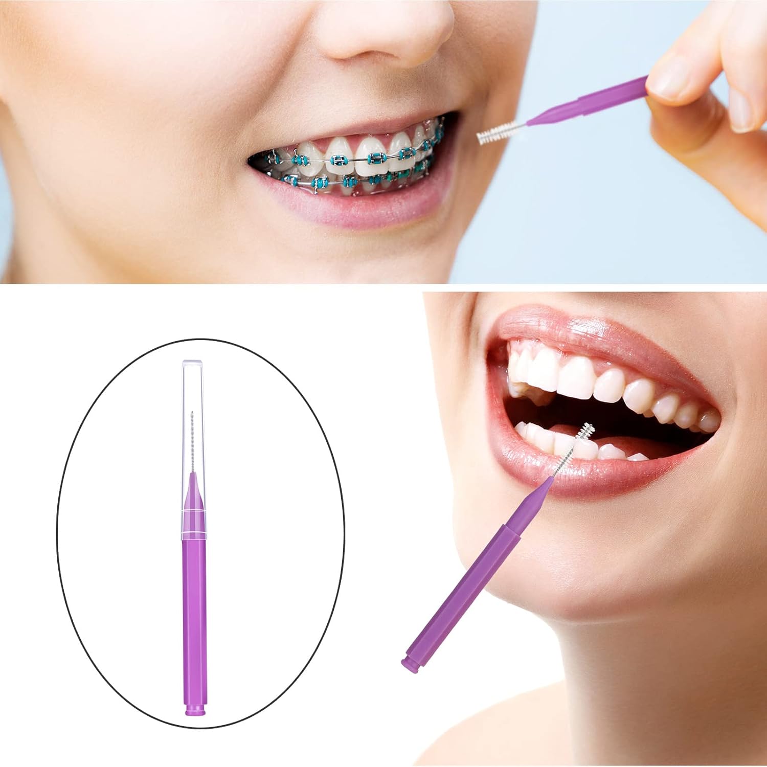 100 Pieces Braces Brush for Cleaner Interdental Brush Toothpick Dental Tooth Flossing Head Oral Dental Hygiene Flosser Toothpick Cleaners Tooth Cleaning Tool (Purple)