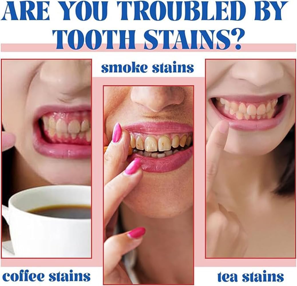 Niacinamide Whitening Toothpaste, Easilyous Radiant Whitening Toothpaste,Fresh Breath,Remove Tooth Stains, 2 Pack