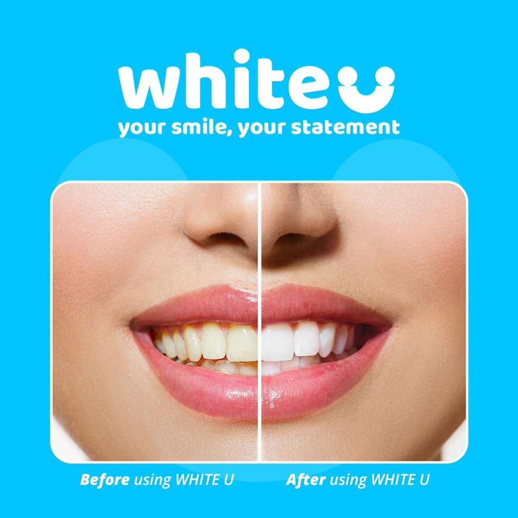 WhiteU Teeth Whitening Strips – 14 Strips – Peroxide-Free, Enamel-Safe, Sensitivity-Free – Advanced Whitening with Pap+ – Professional Dental Care for Whiter Teeth, Tartar Control – Mint Flavored