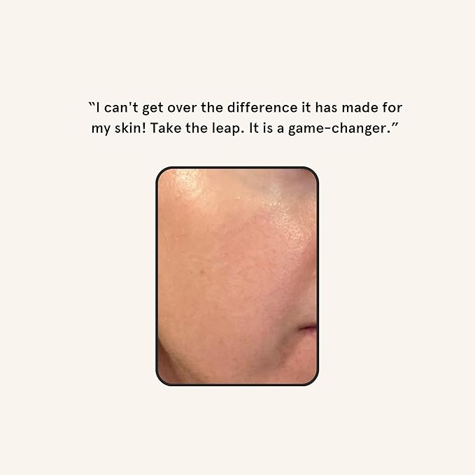 Barefaced Facial Razor – Stainless Steel Dermaplaning Tool for Women – Facial Shaving Tool Removes Peach Fuzz & Dead Skin, Improves Skincare Absorption, Brightens Skin & Smooths Makeup Application