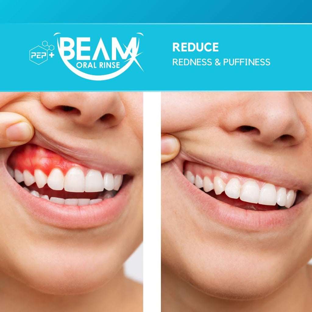 PEP+ BEAM Alcohol-Free Fluoride-Free Mouthwash with Peptides and Xylitol, Oral Rinse for Enamel Strength, Gum Support, Fresh Breath, Microbiome Balance, Dentist Inspired, Travel Size 3.4oz (2 Pack)