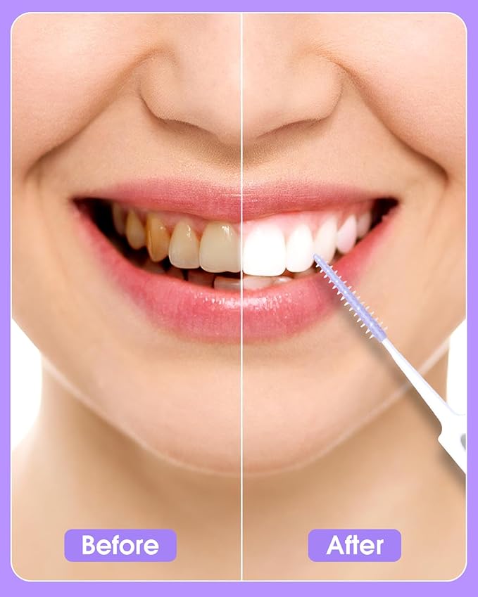 220 PCS Dental Floss Picks, Soft Silicone interdental Brush, Floss Picks for Teeth, Toothpicks Brush Between Teeth, Tooth Flossing Brush with Case, Disposable for Teeth Cleaning, Purple Color