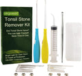 Airgoesin™ 6.75 inch Tonsil Stone Remover LED Tool Kit - 2 Sets, Oral Irrigation Syringe & Stainless Steel Pick, Tonsil Stone Removal Kit for Breath Freshening