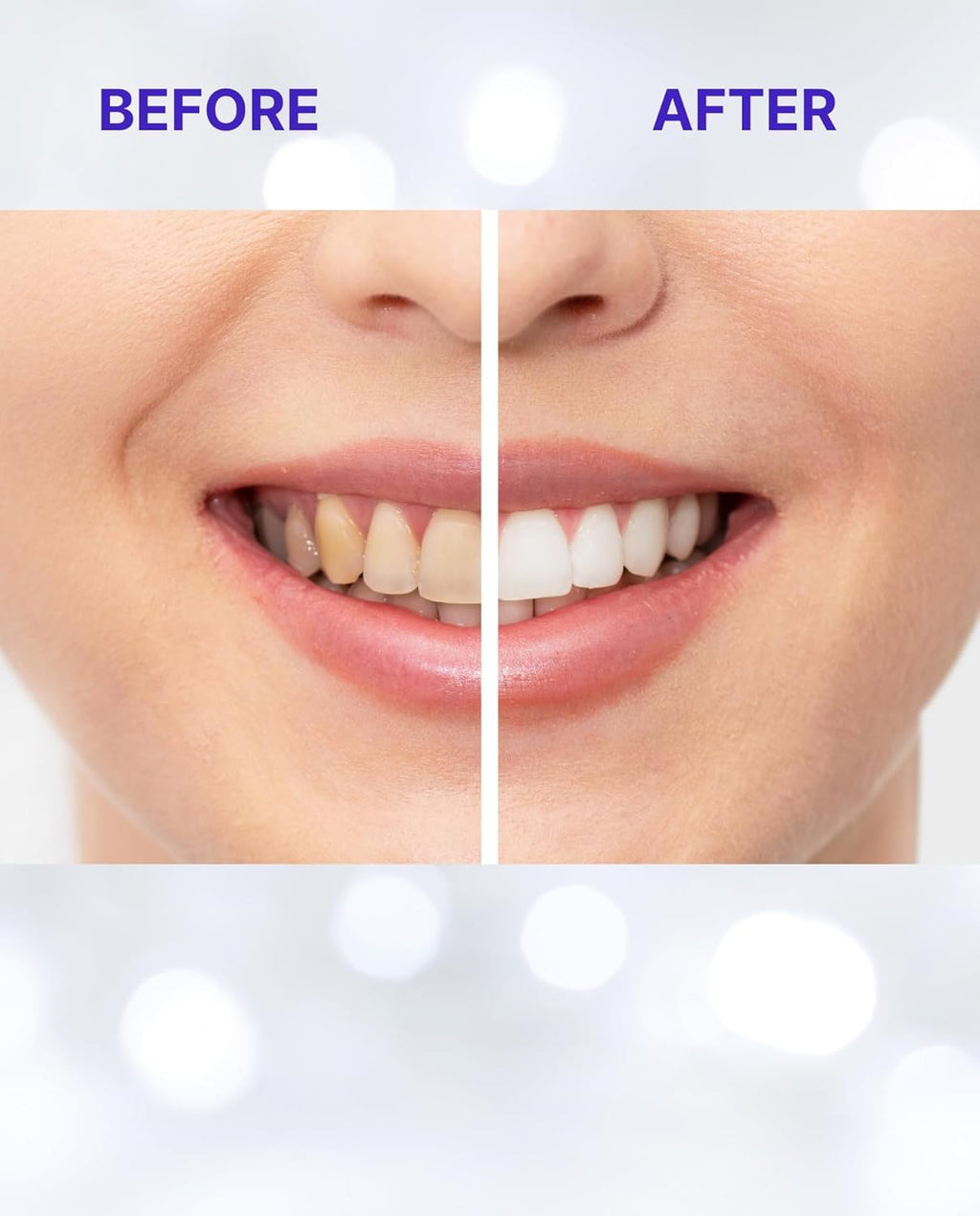 Teeth Whitening Strips for Sensitive Teeth | 14-Day Full Treatment Whitening Kit | Fast-Acting Whitening | Removes Tough Stains | Easy to Use, Comfortable Fit | Self Care & Personal Care Products