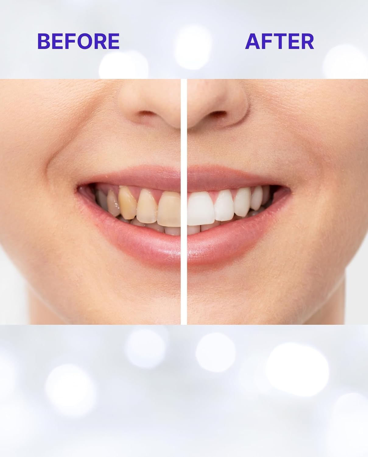 Teeth Whitening Strips for Sensitive Teeth | 14-Day Full Treatment Whitening Kit | Fast-Acting Whitening | Removes Tough Stains | Easy to Use, Comfortable Fit | Self Care & Personal Care Products