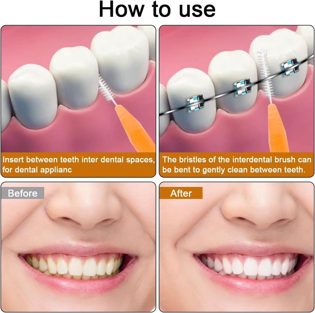 120 Pcs Interdental Brush + 25 Pcs Lip Wands Applicators Disposable, Braces Brush for Cleaner Interdental Brush Toothpick Dental Flossing Oral Dental Hygiene Flosser Tooth Cleaning Tools, Multicolor