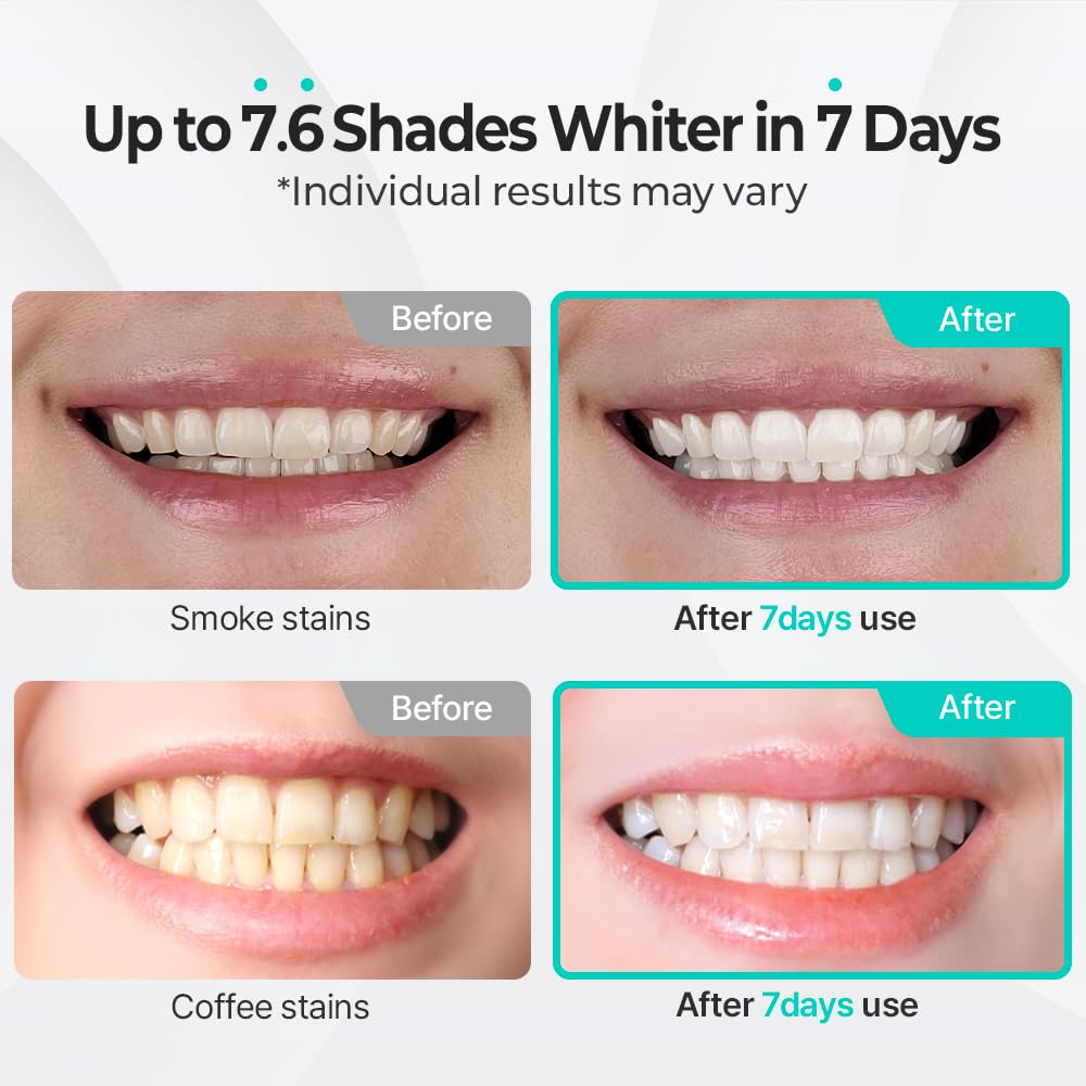 Puredia Whitening Toothpaste 80g – Fluoride-Free, Nano Hydroxyapatite & Hydrogen Peroxide, Sensitive Teeth, Enamel Strengthening, Natural Mint Gel