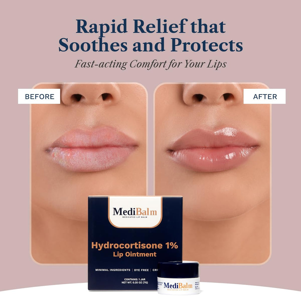 1% Hydrocortisone Lip Balm – Petrolatum-Free Relief for Chapped, Dry, or Irritated Lips due to Accutane, Isotretinoin associated Cheilitis, Weather Damage, and more - Unflavored