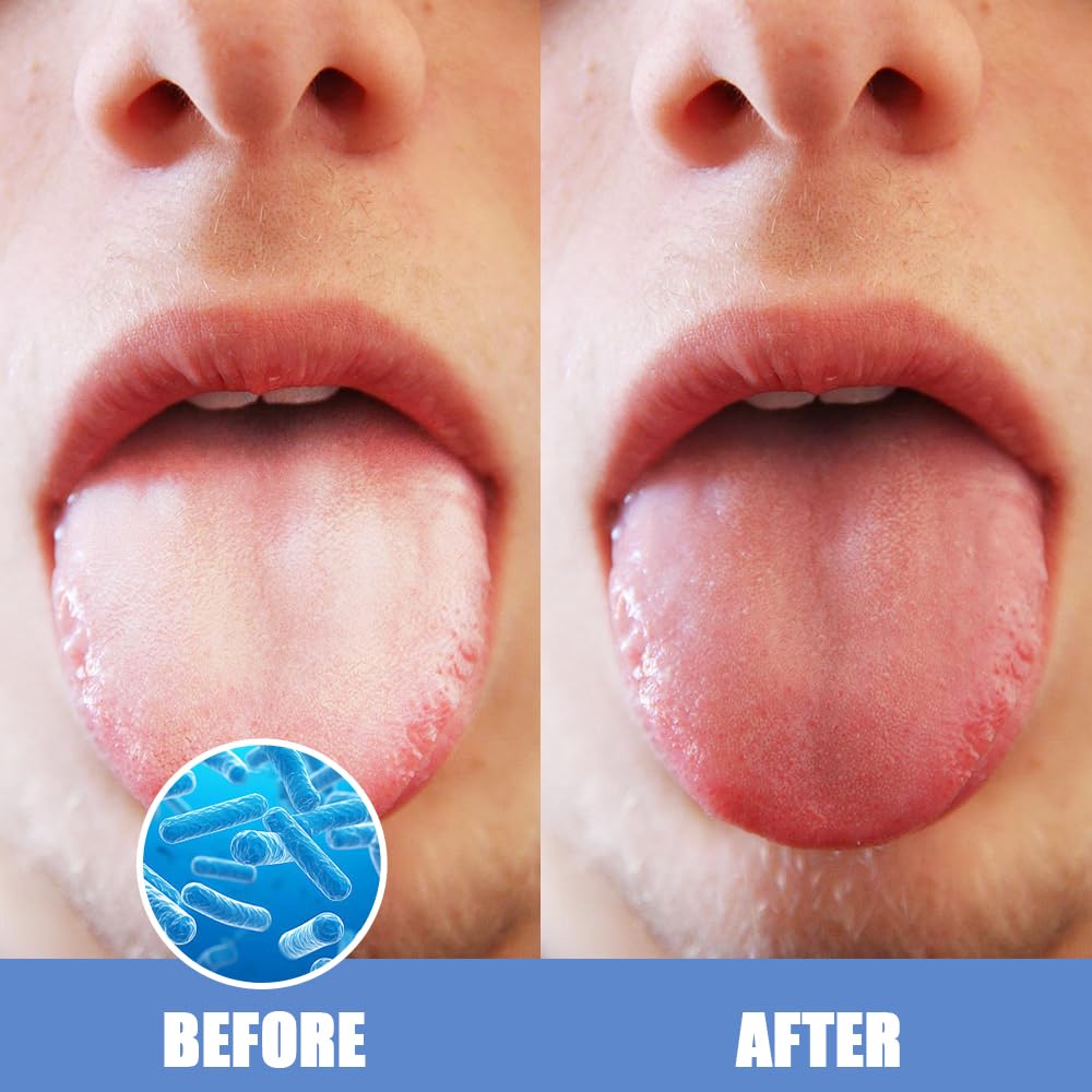 Tongue Scraper for Adults Oral Care Tongue Cleaner Reduce Bad Breath Metal Tongue Scrubber Stainless Steel (Silver, Pack of 2)