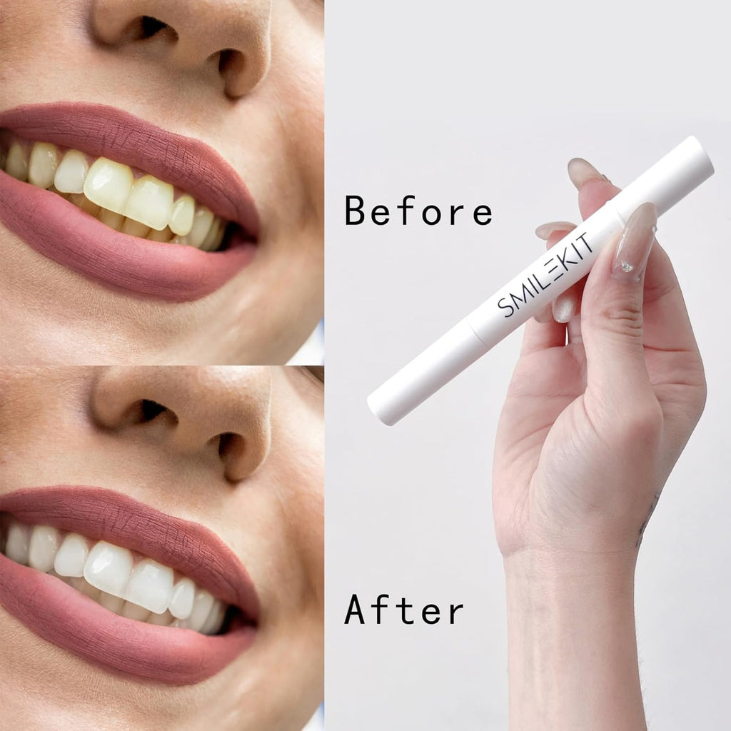 Portable Teeth Whitening Pen (2 Count) - Easily Removes Stains, Effective, Painless, Non-Irritating, and Travel-Friendly.