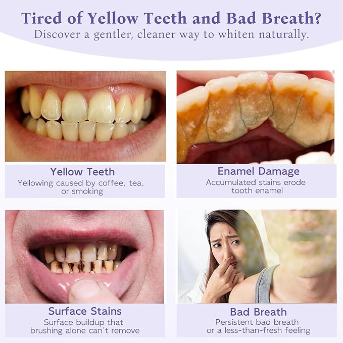 Teeth Whitening Powder with 20,000ppm Hydroxyapatite & 20,000ppm Niacinamide – Instant Brightening, Patent-Pending R5X Remineralizing Complex, Purple Color Corrector Mint Formula, 50g, 3-Month Supply