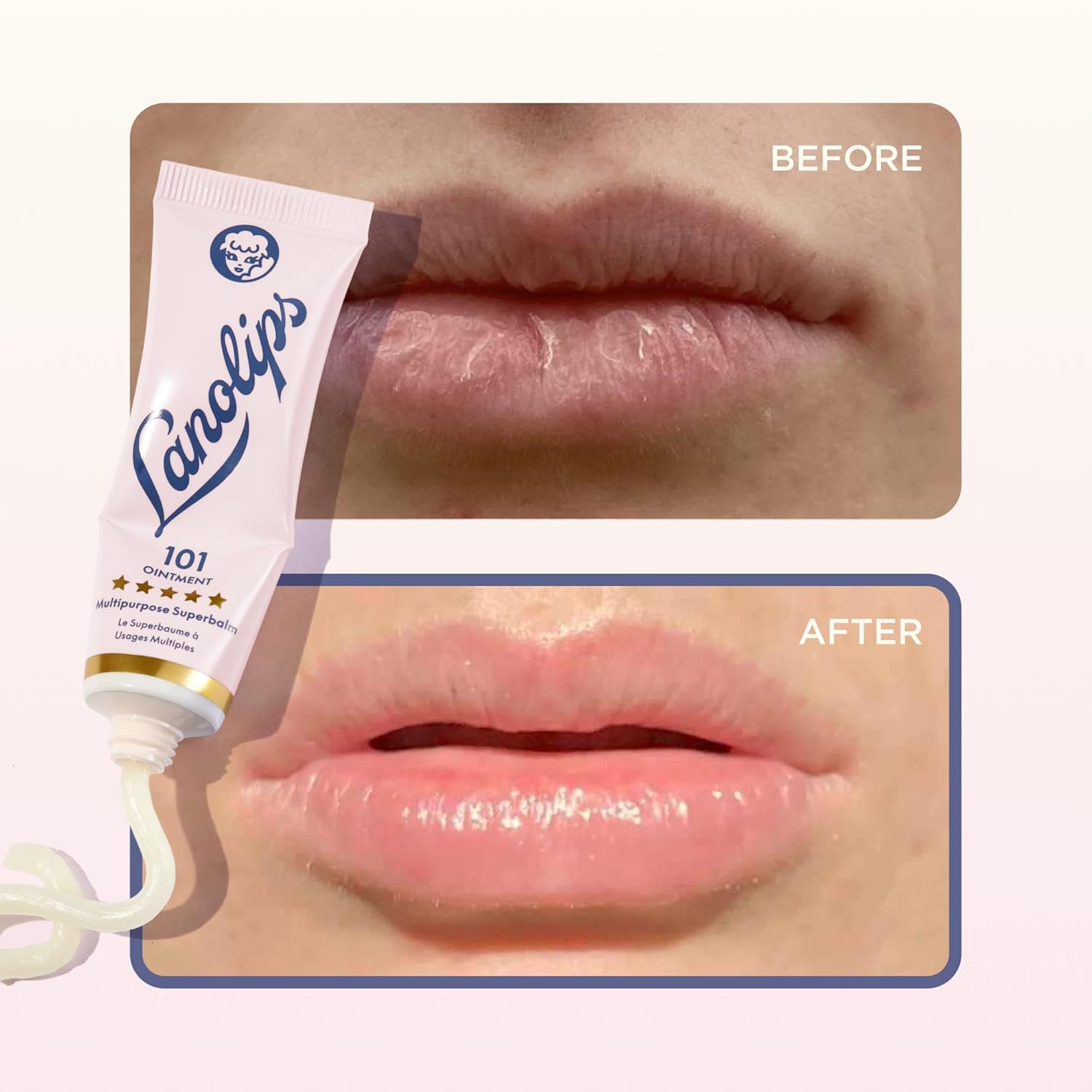 Lanolips 101 Ointment - Lanolin Lip Balm for Smooth, Hydrated & Healthy Lips - Multipurpose Lip Ointment with Lanolin Oil for Dry Lips, Cuticles & More - Original Superbalm (0.52 oz)