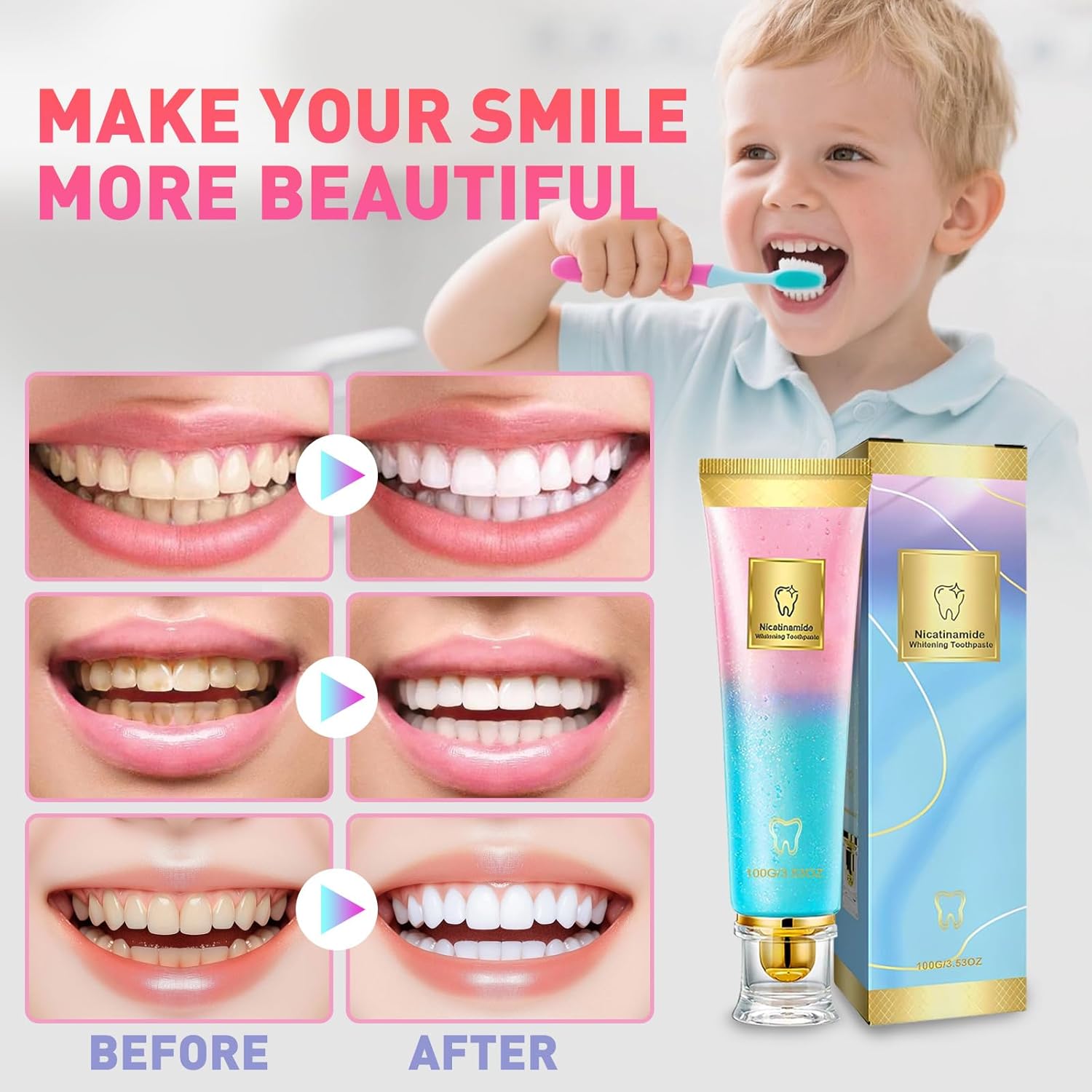 2Pcs Niacinamide Whitening Toothpaste, Bright White Toothpaste for Fresh Breath, Nicotinamide Dazzling White Toothpastes, Removal Tooth Stains, Complete Care Dazzling White Toothpastes