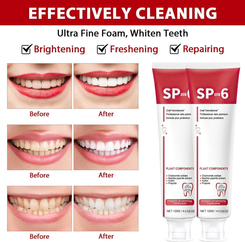 2Pcs Sp-6 Ultra Whitening, Sp-6 Probiotic Whitening Toothpaste, Deep Cleaning Care Toothpaste 120g