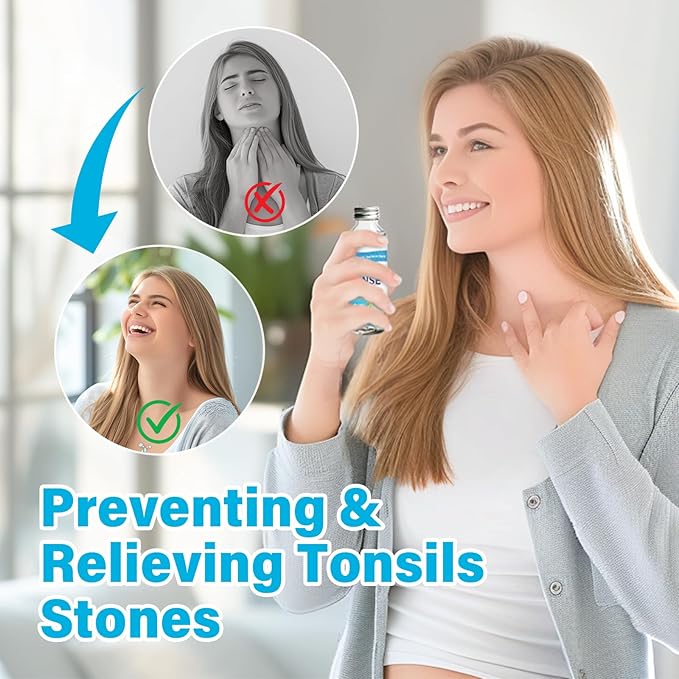 Tonsil Stone Remover, Natural Oral Rinse Liquid wihout Alcohol, Tonsil Stone Mouthwash to Help Soothe Tonsils, Fight Bad Breath, 4 Fl Oz