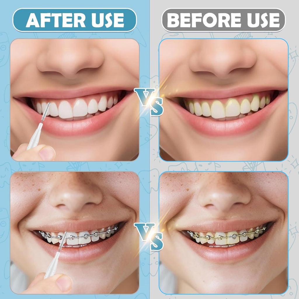 120 Pieces Braces Dental Brush Flosser for Cleaner Interdental Brushes Between Teeth with Soft Bristles 360° Bendable Toothpick Dental Tooth Flossing Oral Dental Hygiene