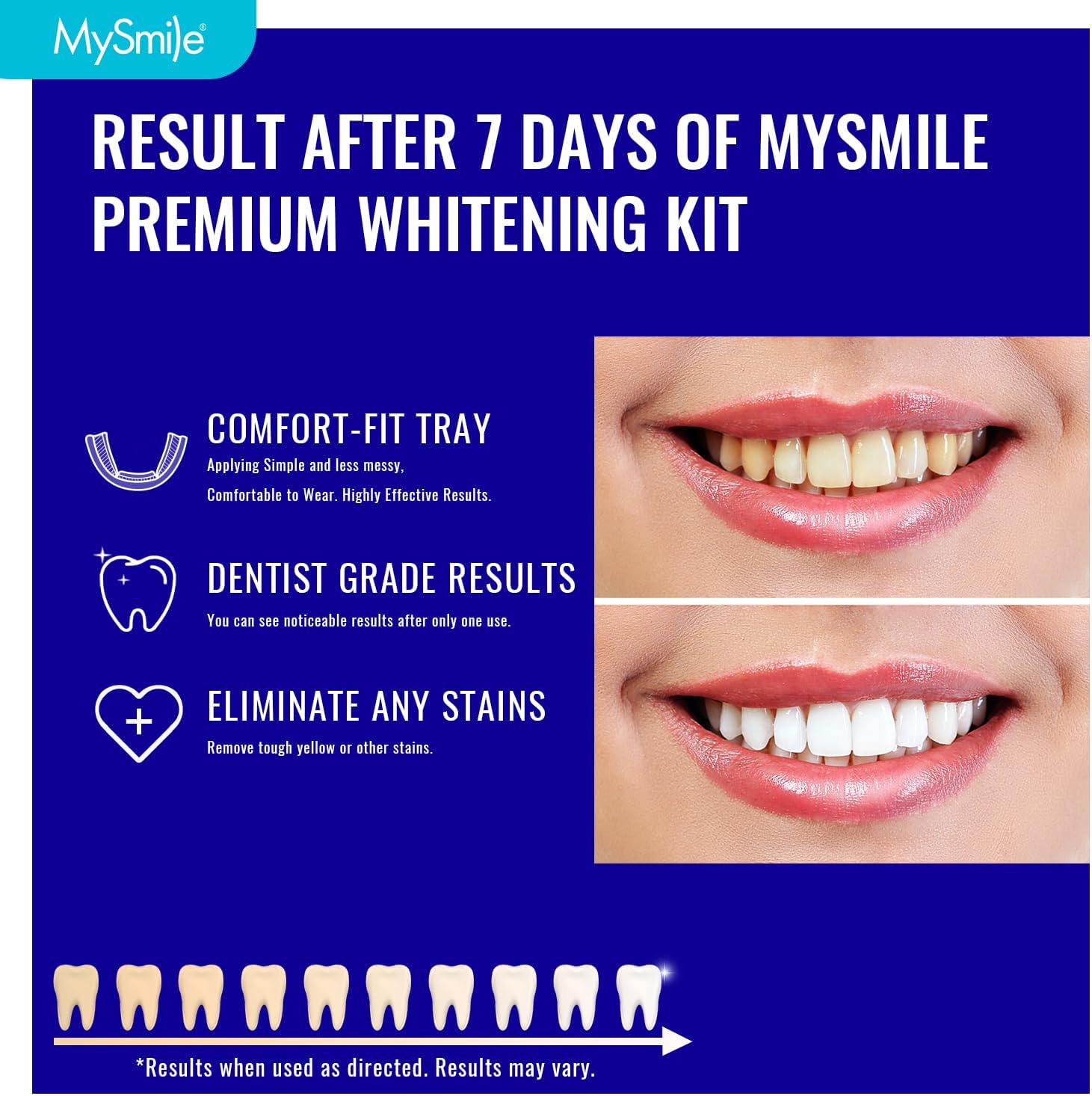 MySmile 7 Treatments Prefilled Teeth Whitening Trays Kit with 12% Hydrogen Peroxide Whiter Gel for Sensitive Tooth, Fast-Result Vegan Teeth Whitener Tooth Stain Remover, Mint Flavor