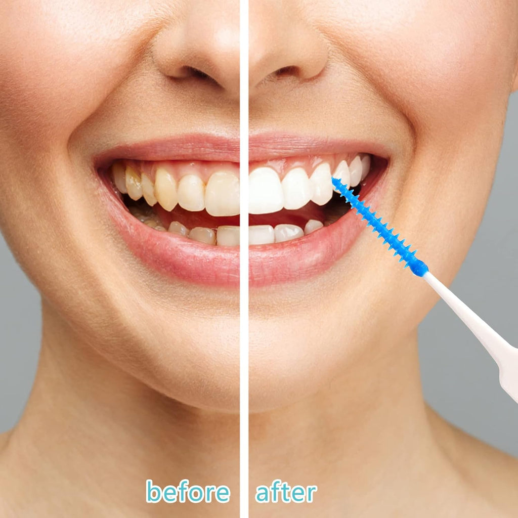 220 Pieces Interdental Brushes, Silicone Dental Floss Picks with Case Dental Brushes Dental Picks Blue Tooth Floss Picks for Teeth Cleaning