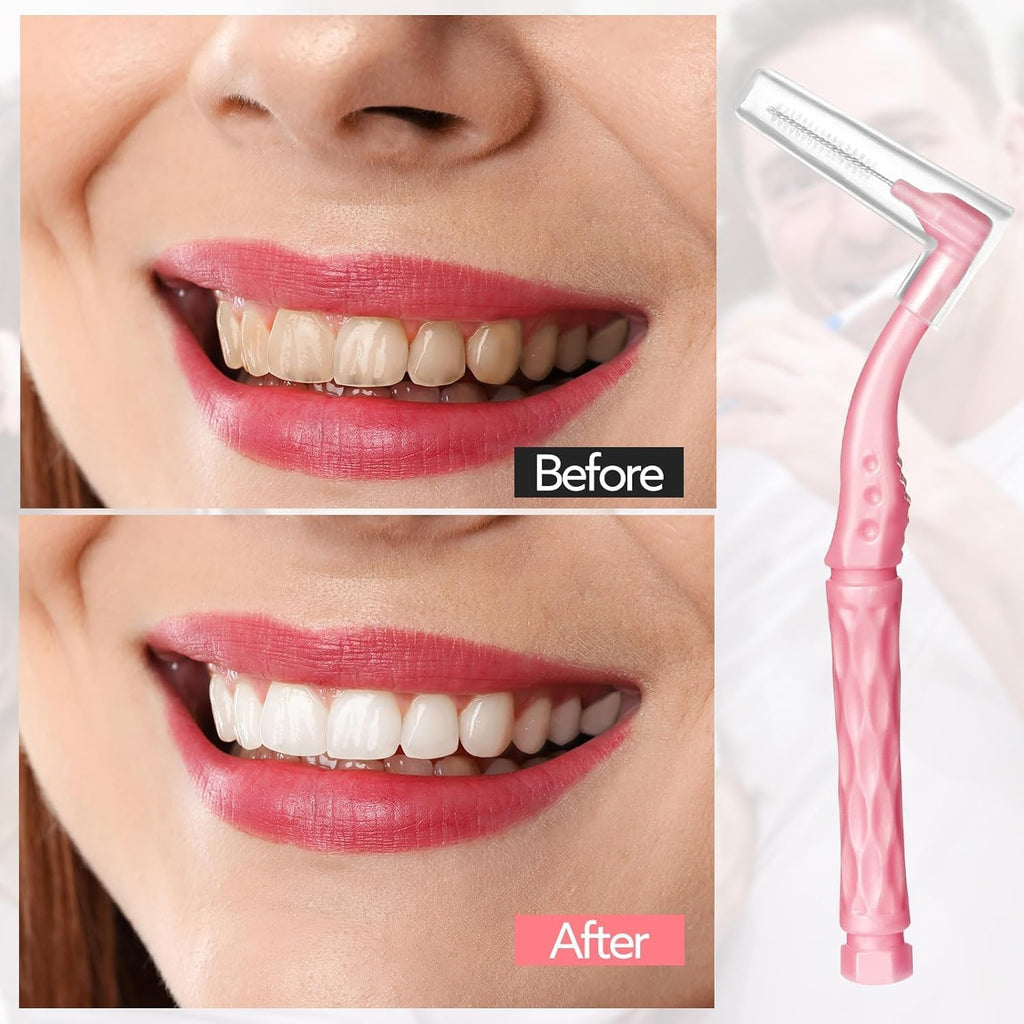 100pcs Interdental Brushes, 5 Sizes Braces Brush Set Soft Dental Brushes with Non-Slip Handle Angled Head Tooth Picks Floss Sticks Dental Floss Brushes for Braces Oral Cleaning