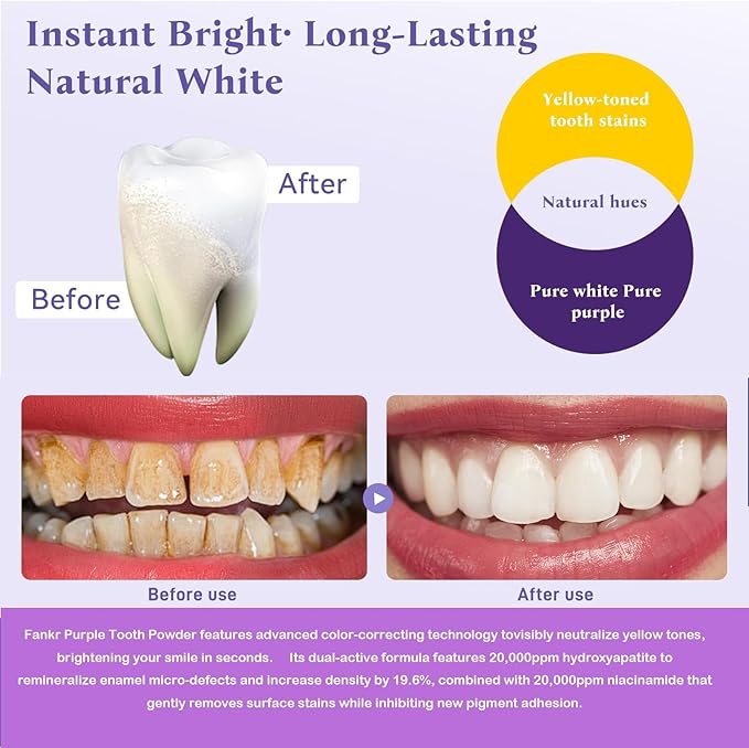 Teeth Whitening Powder with 20,000ppm Hydroxyapatite & 20,000ppm Niacinamide – Instant Brightening, Patent-Pending R5X Remineralizing Complex, Purple Color Corrector Mint Formula, 50g, 3-Month Supply