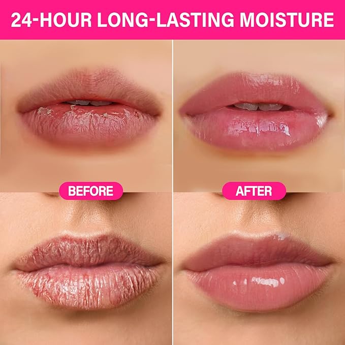 Lip Mask Set, Overnight Lip Sleeping Mask with Shea Butter & Vitamin C for Nourishing Hydration, Moisturizing Lip Balm Treatment for Dry, Flaky Lips, Lip Care Holiday Gift for Women & Teen Girls