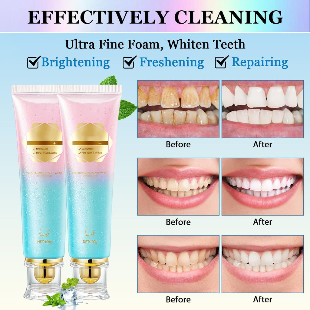 Niacinamide Whitening Toothpaste Acssart Radiant White Toothpaste,Niacinamide Intensive Whitening Toothpastes,Nicotinamide Radiant Whiten Toothpastes (1)