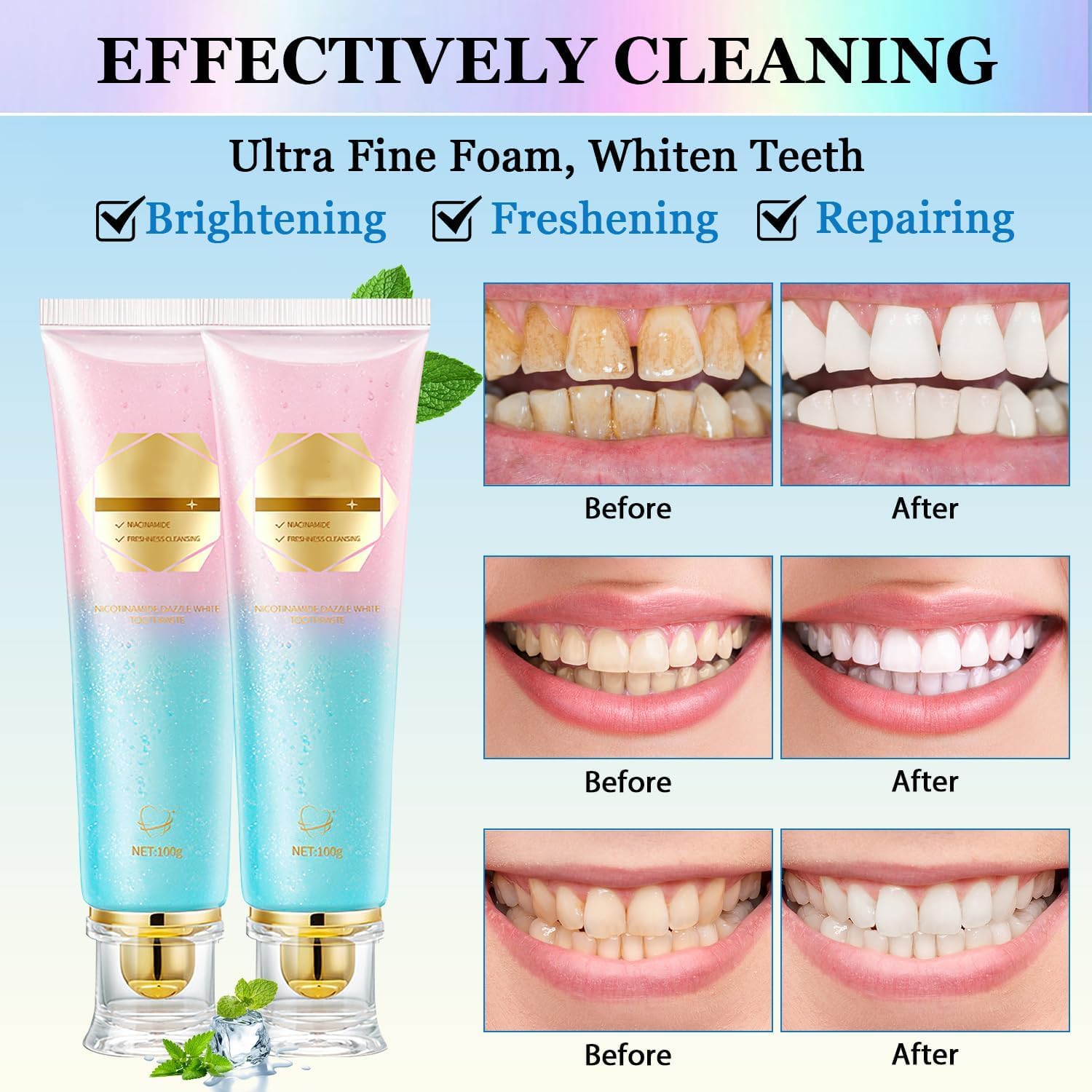Niacinamide Whitening Toothpaste Acssart Radiant White Toothpaste,Niacinamide Intensive Whitening Toothpastes,Nicotinamide Radiant Whiten Toothpastes (1)