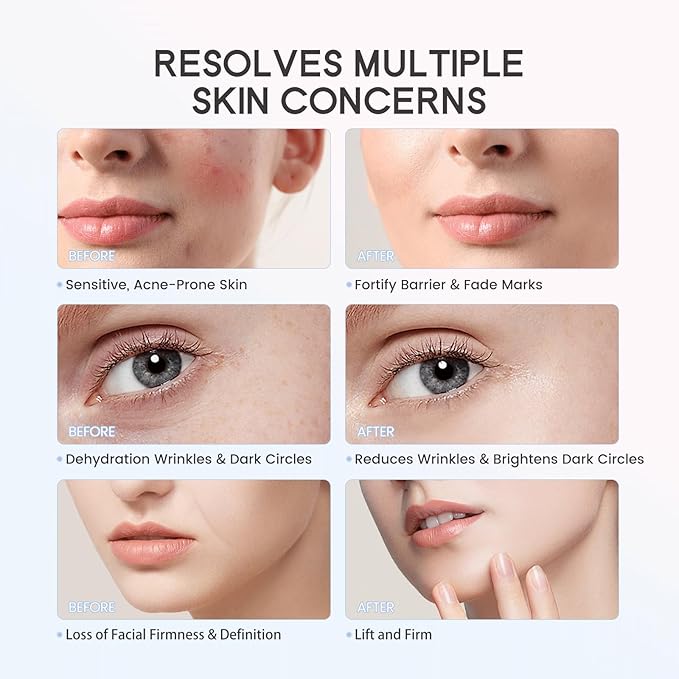 LULUROSE Facial Massager with Cold Heat Light Vibrating for Face,5-in-1 Facial Device with LED Display for Skin Care Wrinkles at Home Traveling 1500mAh