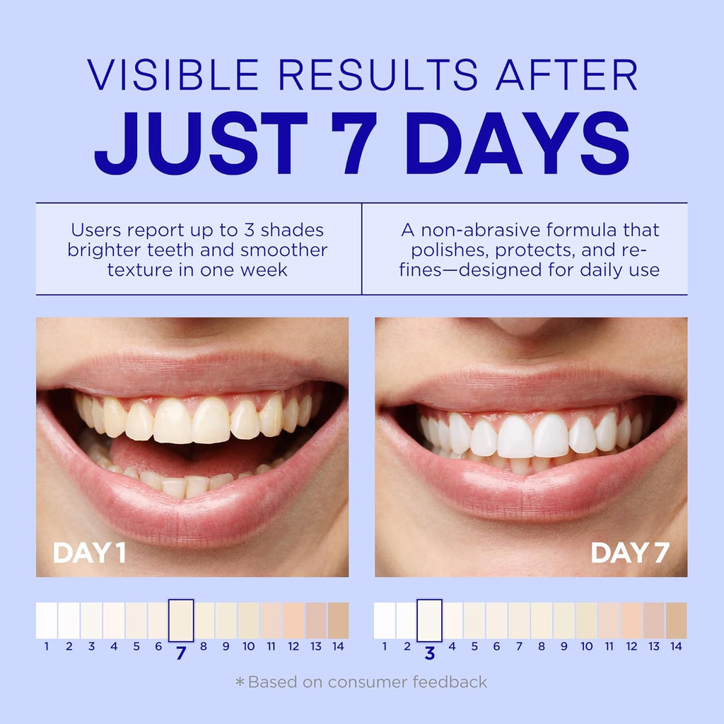 PearlSmile Niacinamide Hydroxyapatite Whitening Toothpaste – 10% Nano Hydroxyapatite + 5% Niacinamide – Strengthens Enamel, Remineralizes, Brightens Teeth – Fluoride-Free, Travel Size, 4.2oz