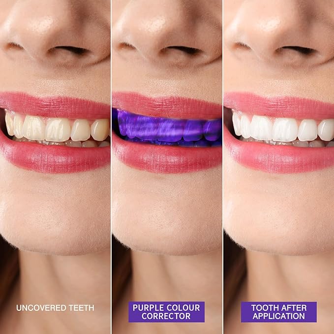 Instant Teeth Whitening Booster, Purple Toothpaste for Teeth Whitening, Purple Toothpaste, Tooth Stain Removal Colour Corrector Serum – Non-Invasive Treatment for Yellow Stains