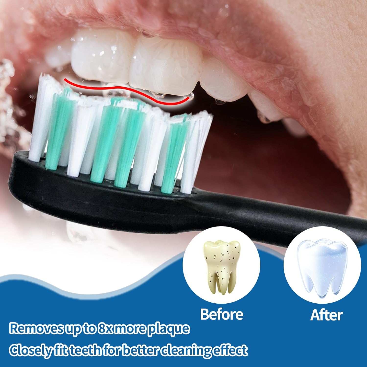 5 Pack Toothbrush Heads Compatible with Kingheroes,Soft Brush Bristles Electric Toothbrush Replacement Heads Compatible with Kingheroes