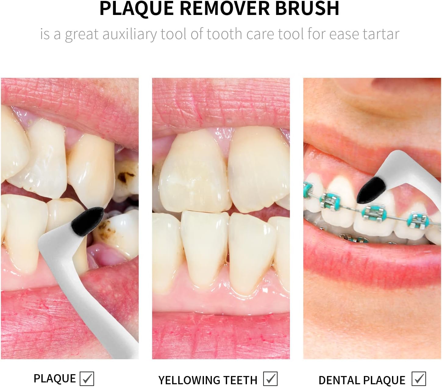 3Pcs Tooth Stain Remover, Teeth Cleaning Calculus Tool, Professional Teeth Whitening Polishing Cleaning Kit, Not Electric Cleaner Brush(White)