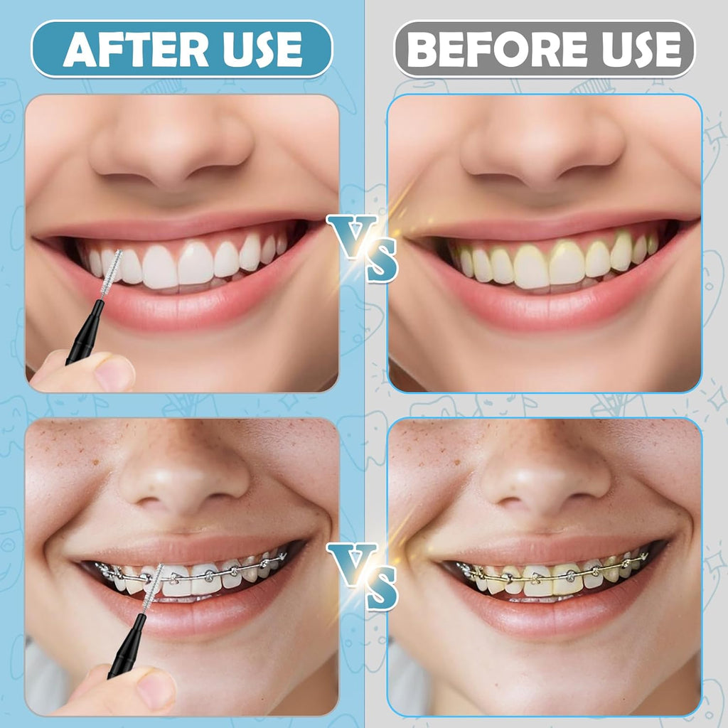 120 Pieces Braces Flossers for Cleaner Interdental Brushes Between Teeth, Toothpick Dental Tooth Flossing with Soft Bristles 360° Bendable Oral Dental Hygiene Flosser Cleaning Tool