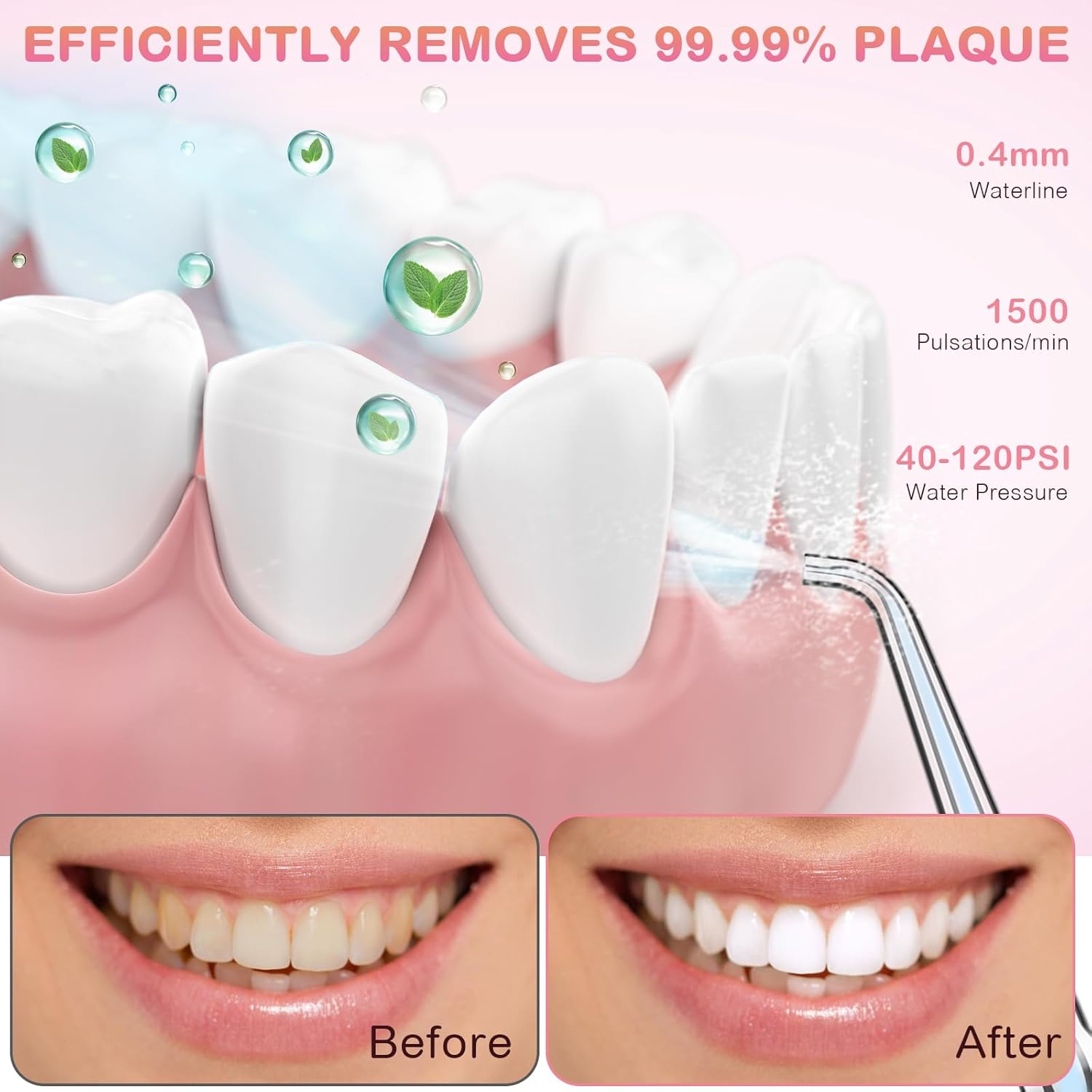 Water Dental Flosser for Teeth Cleaning and Flossing with Travel Size Case – Rechargeable Oral Irrigator, KOOVON Portable Water Flosser for Adults, IPX7 Waterproof, 5 Jet Tips & 4 Modes, Pink