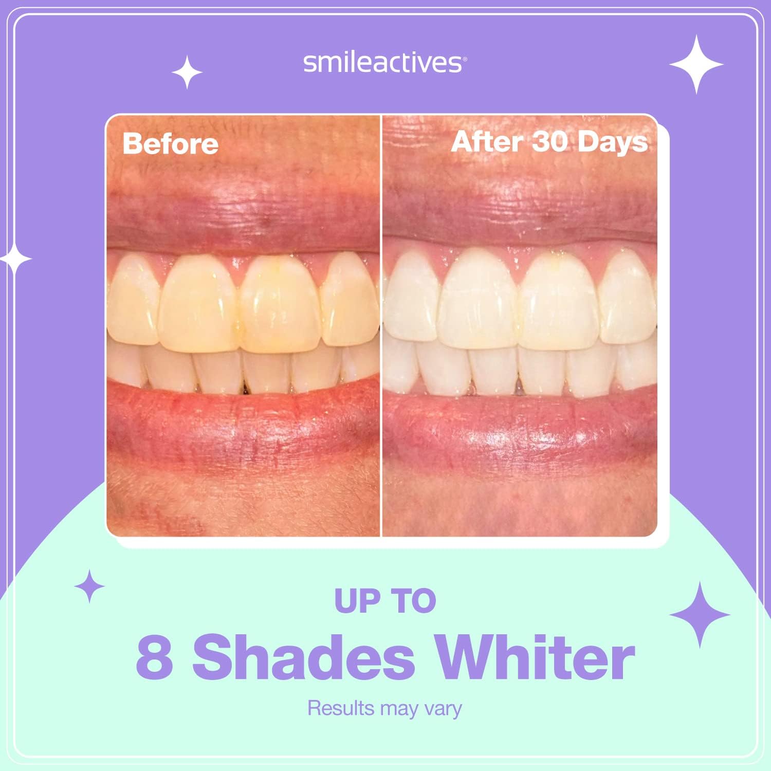 Smileactives Teeth Whitening Kit, Complete at Home Teeth Whitening Treatment, Travel Size Tooth Whitening, Stain Remover for White Teeth, Contains Clinical-Grade Hydrogen Peroxide, 60 Day Kit